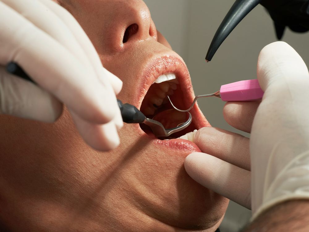 Hygienist performing an oral health assessment